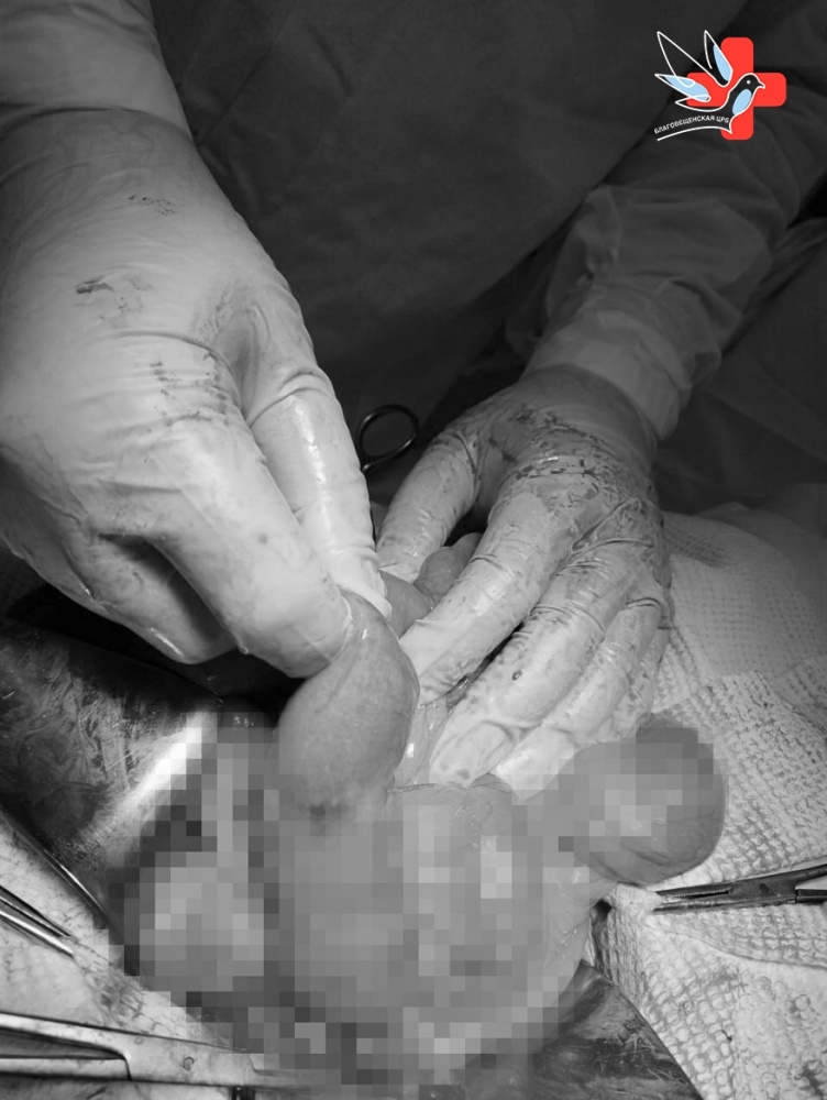 Клинический случай